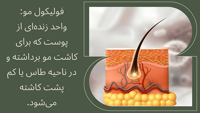 فولیکول مو آماده برای کاشت
