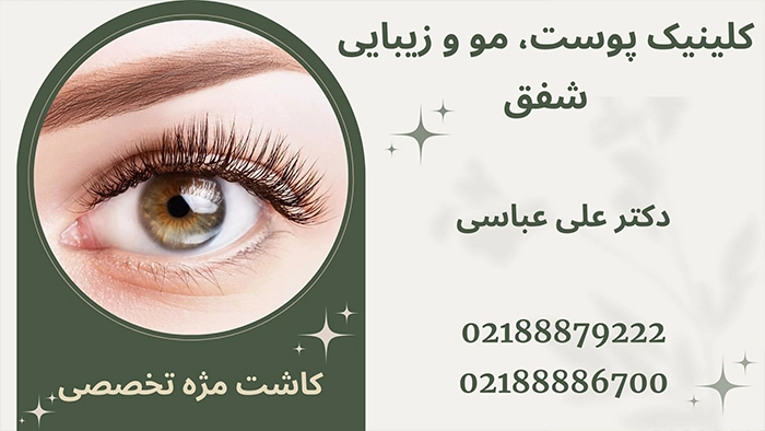 کاشت مژه